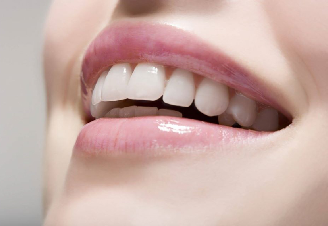白い歯にしたい方へのホワイトニング