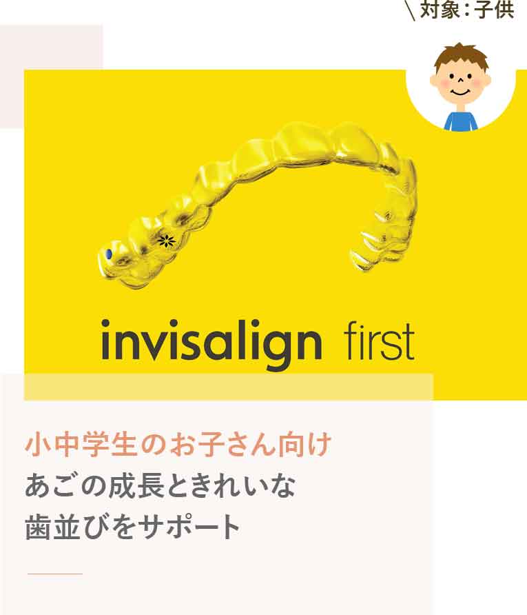 インビザライン®ファースト