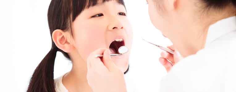 虫歯のチェック